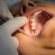 cirugías dentales