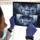 diseño CAD CAM dental