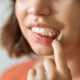 diferencia entre gingivitis y periodontitis