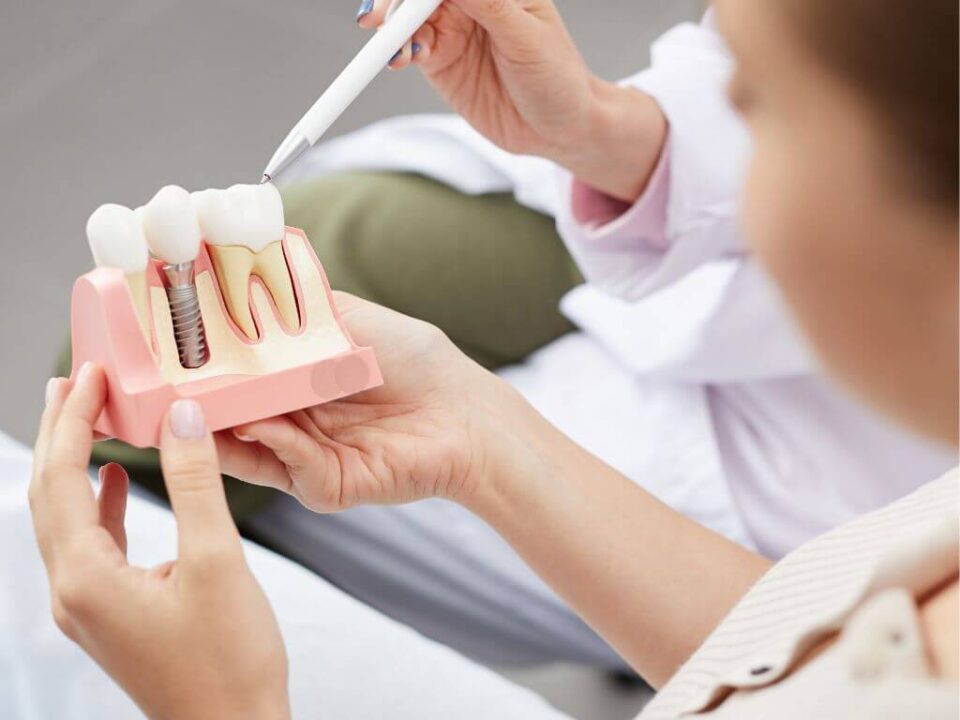 cuánto dura un implante dental