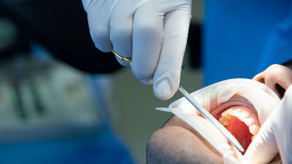 cuidado tras una cirugía dental