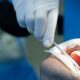 cuidado tras una cirugía dental