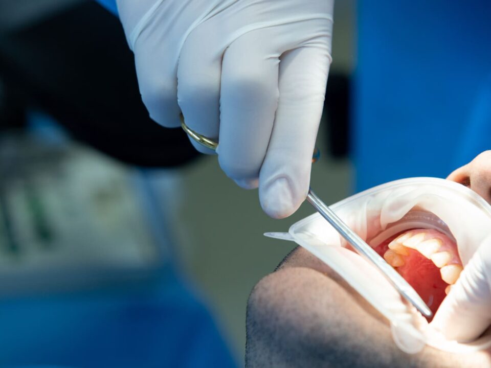 cuidado tras una cirugía dental