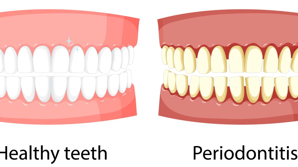 periodoncia