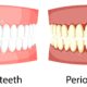 periodoncia