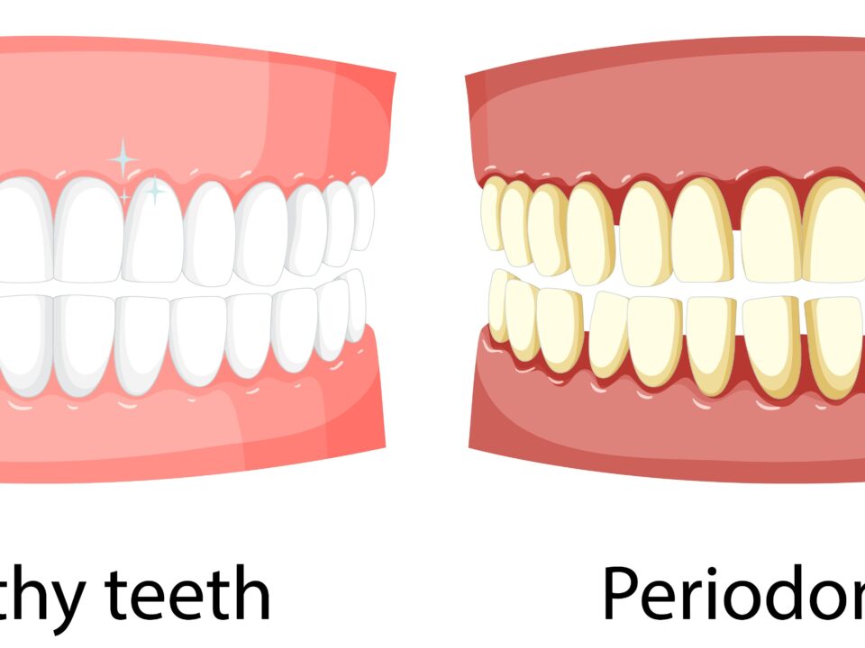 periodoncia