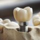 implante dental sin hueso