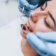 Cómo se forman las caries