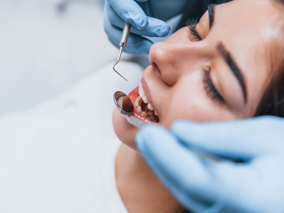 Cómo se forman las caries