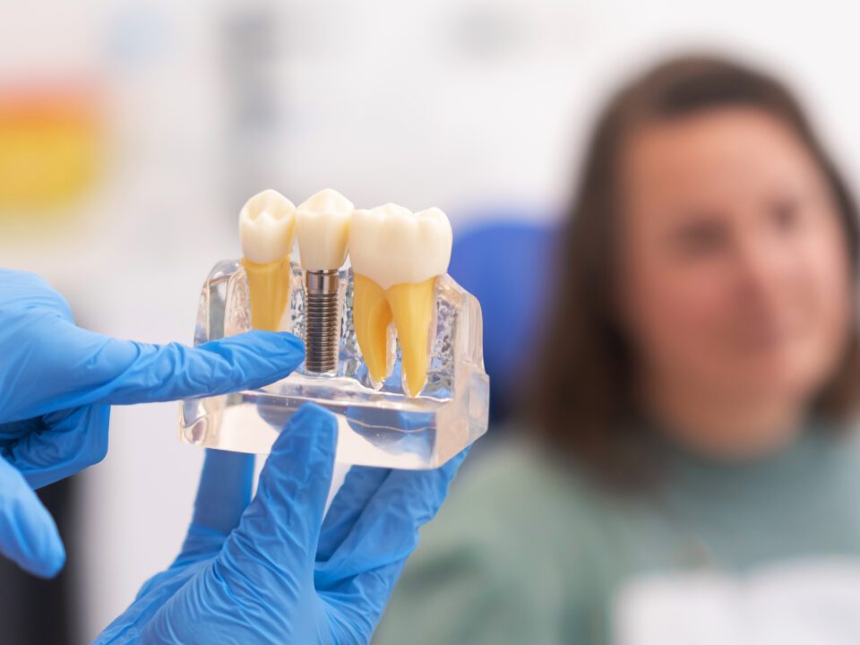 Alternativas al implante dental