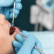 Por qué se produce la gingivitis