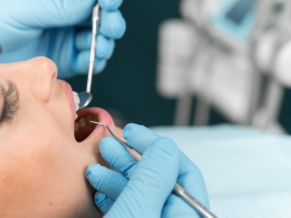 Por qué se produce la gingivitis