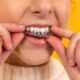 Cómo limpiar la férula dental