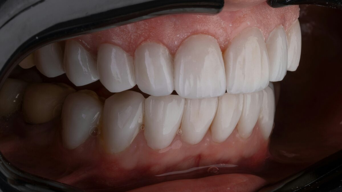 Qué es la dentina