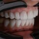 Qué es la dentina