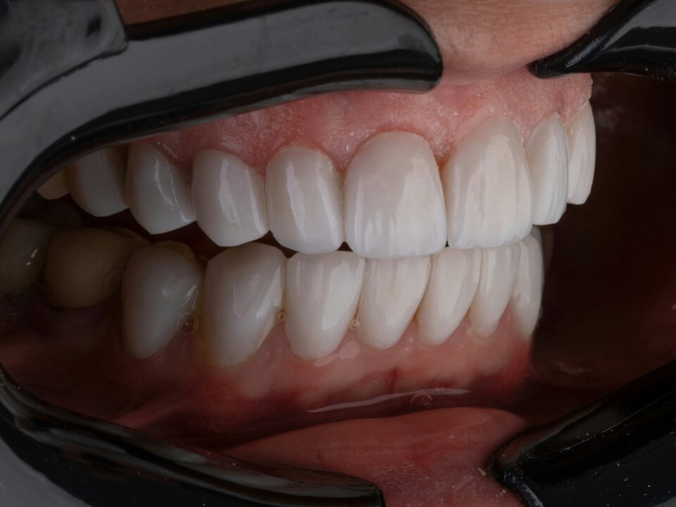 Qué es la dentina