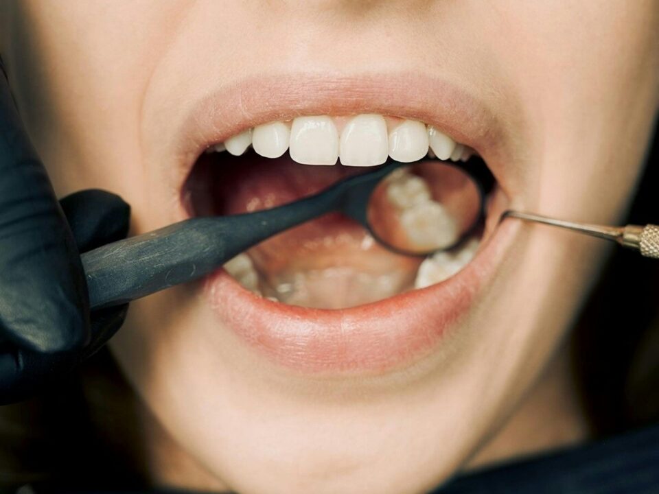 Qué es la regeneración ósea dental