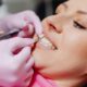 Pérdida de esmalte dental
