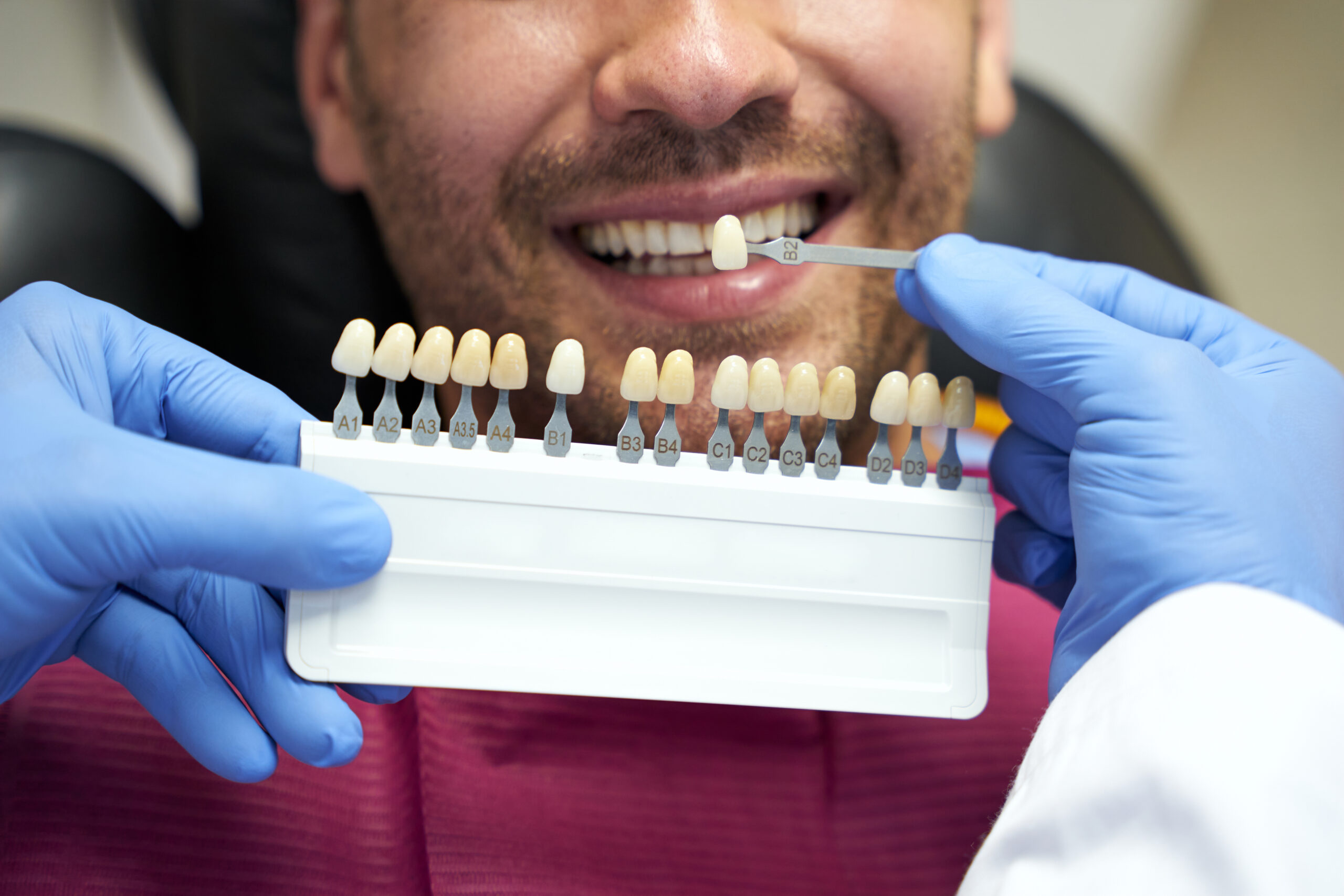 Cómo recuperar el esmalte de los dientes
